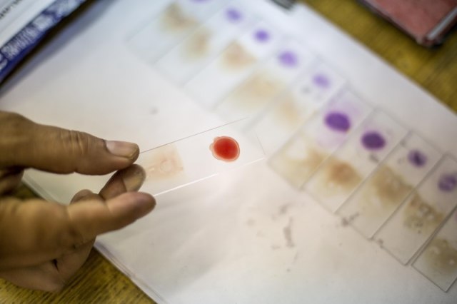 Britanci pokreæu najveæe probno testiranje krvi na 50 tipova raka